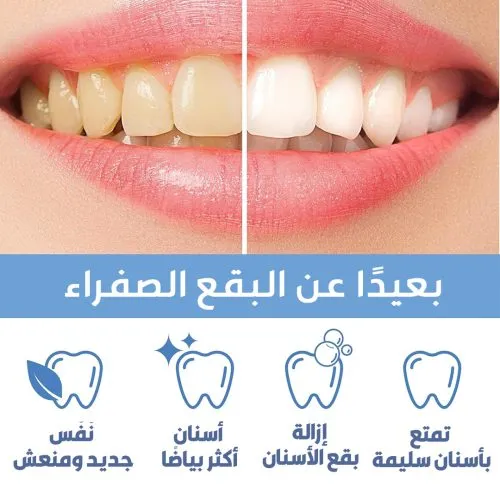 Stylo blanchissant pour les dents en 2 parties avec applicateur doux